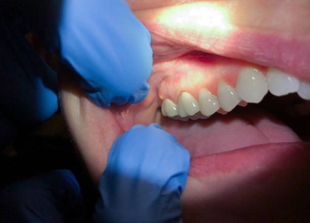 Best Emergency Treatment for Toothache in Hartford, IL