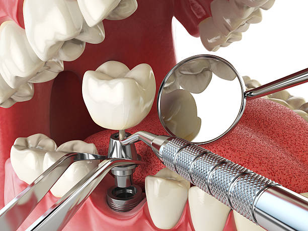 Best Pediatric Emergency Dentist in Hartford, IL